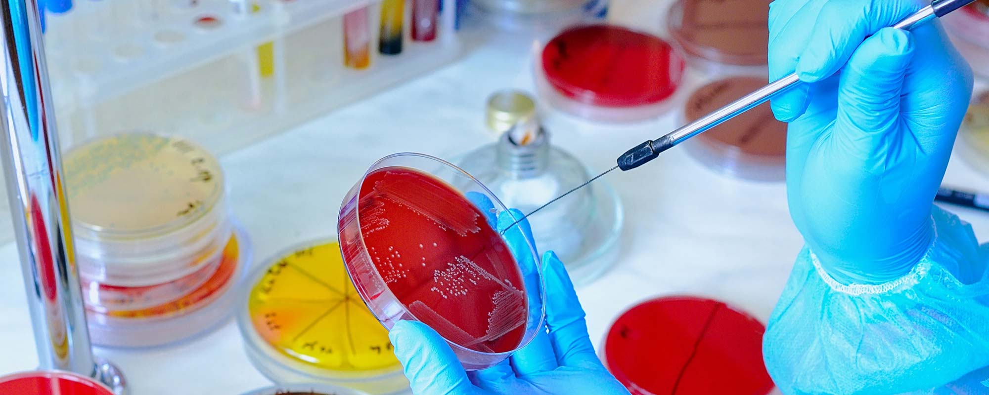Laboratory analysis of collected samples